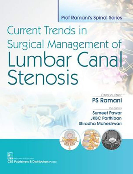 CURRENT TRENDS IN SURGICAL MANAGEMENT OF LUMBAR CANAL STENOSIS (PB 2019) - Retail Maharaj