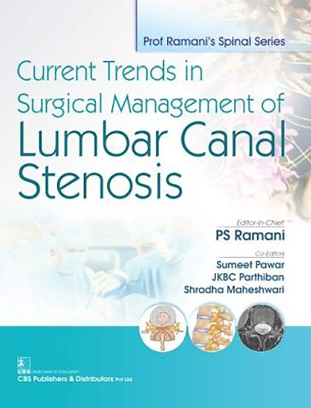 CURRENT TRENDS IN SURGICAL MANAGEMENT OF LUMBAR CANAL STENOSIS (PB 2019) - Retail Maharaj