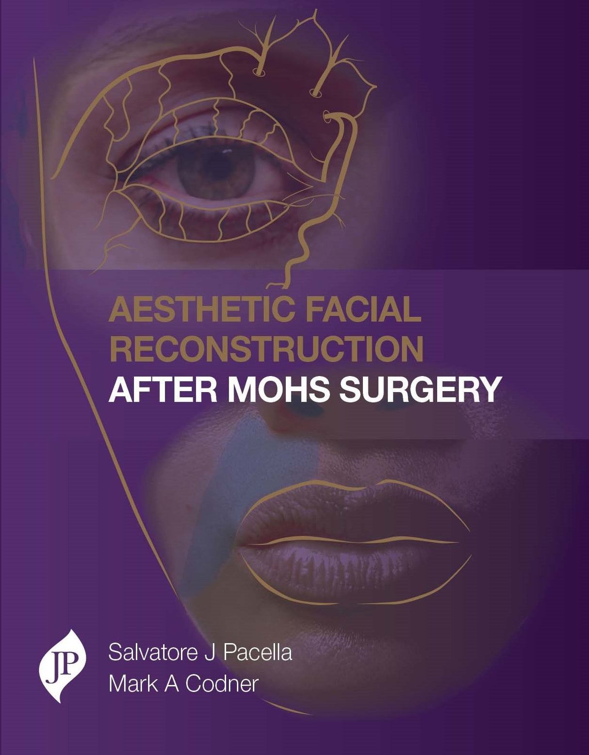 Aesthetic Facial Reconstruction After Mohs Surgery - Retail Maharaj