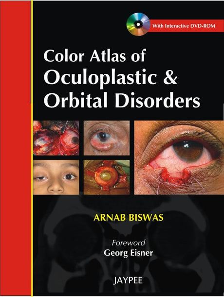 Color Atlas of Oculoplastic & Orbital Disorders with Interactive DVD-ROM - Retail Maharaj