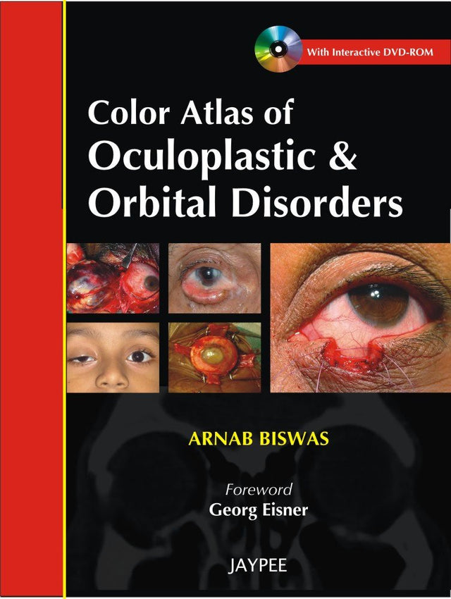 Color Atlas of Oculoplastic & Orbital Disorders with Interactive DVD-ROM - Retail Maharaj