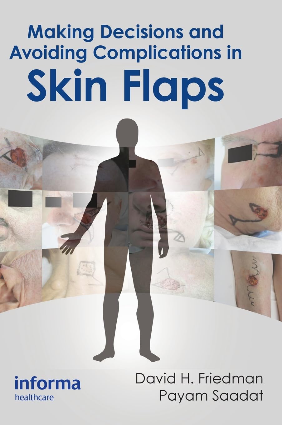 Making Decisions And Avoiding Complications In Skin Flaps (Ex) - Retail Maharaj