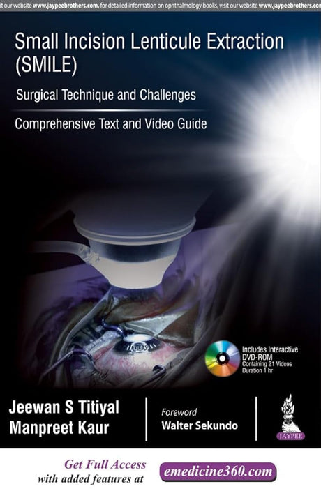 SMALL INCISION LENTICULE EXTRACTION (SMILE) SURGICAL TECHNIQUE AND CHALLENGES:COMPREHENSIVE TEXT - Retail Maharaj