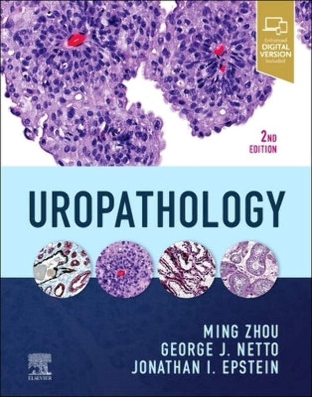 UROPATHOLOGY, 2ND EDITION - Retail Maharaj