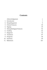Staging and Grading of Oral Squamous Cell Carcinoma - Retail Maharaj