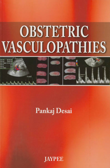 OBSTETRIC VASCULOPATHIES - Retail Maharaj