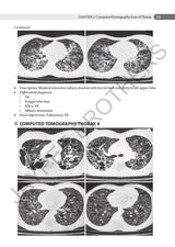 AN AID TO RESPIRATORY MEDICINE FOR POSTGRADUATE EXIT EXAM (MD, DNB AND DIPLOMA) - Retail Maharaj