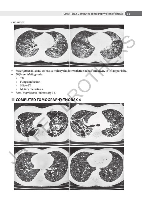 AN AID TO RESPIRATORY MEDICINE FOR POSTGRADUATE EXIT EXAM (MD, DNB AND DIPLOMA) - Retail Maharaj