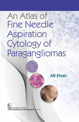 An Atlas of Fine Needle Aspiration Cytology of Paragangliomas - Retail Maharaj