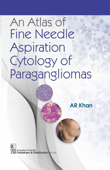 An Atlas of Fine Needle Aspiration Cytology of Paragangliomas - Retail Maharaj
