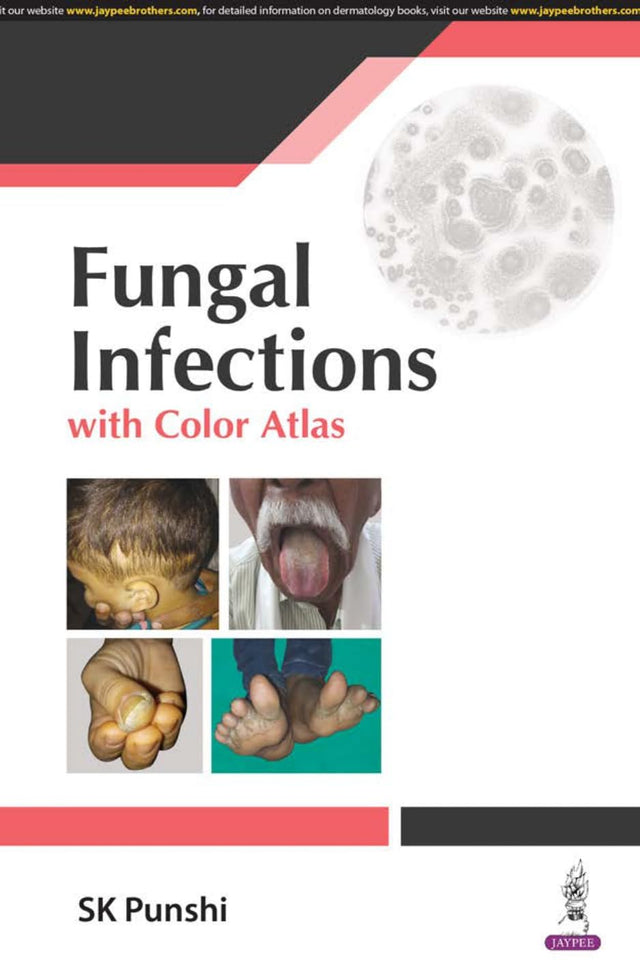 FUNGAL INFECTIONS WITH COLOR ALTAS - Retail Maharaj