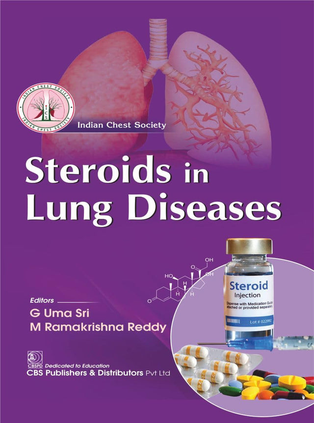 Steroids in lung diseases - Retail Maharaj