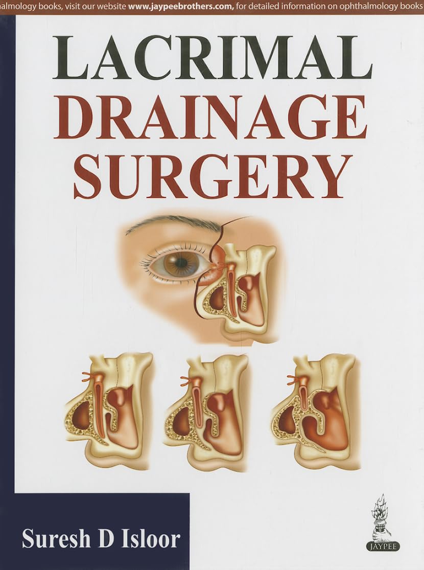 Lacrimal Drainage Surgery - Retail Maharaj