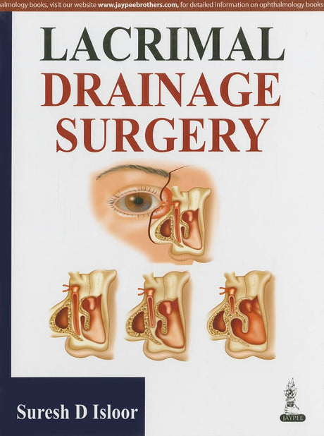 Lacrimal Drainage Surgery - Retail Maharaj