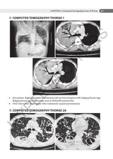 AN AID TO RESPIRATORY MEDICINE FOR POSTGRADUATE EXIT EXAM (MD, DNB AND DIPLOMA) - Retail Maharaj