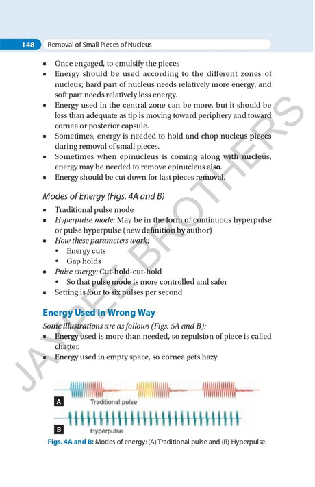 SIMPLIFIED PHACOEMULSIFICATION - Retail Maharaj