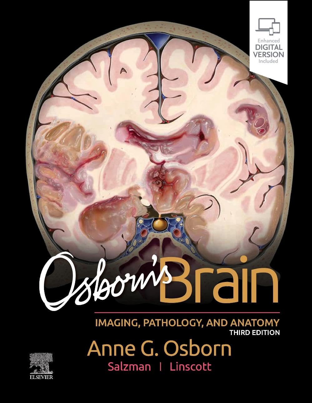 OSBORNS BRAIN IMAGING PATHOLOGY AND ANATOMY WITH ACCESS CODE 3ED (HB 2024) - Retail Maharaj