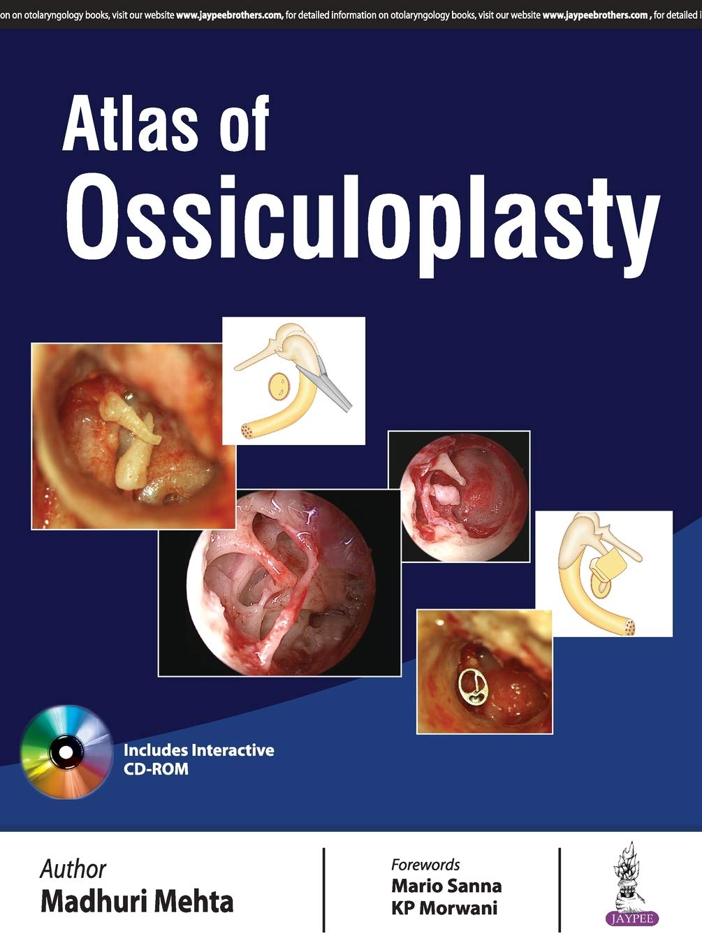 ATLAS OF OSSICULOPLASTY - Retail Maharaj