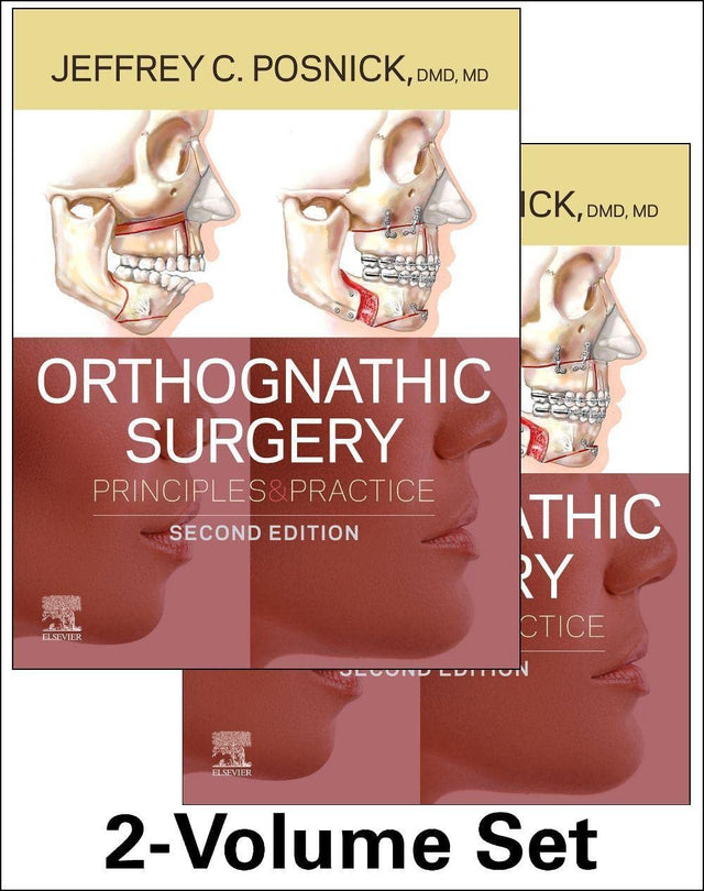 Orthognathic Surgery - 2 Volume Set - Retail Maharaj