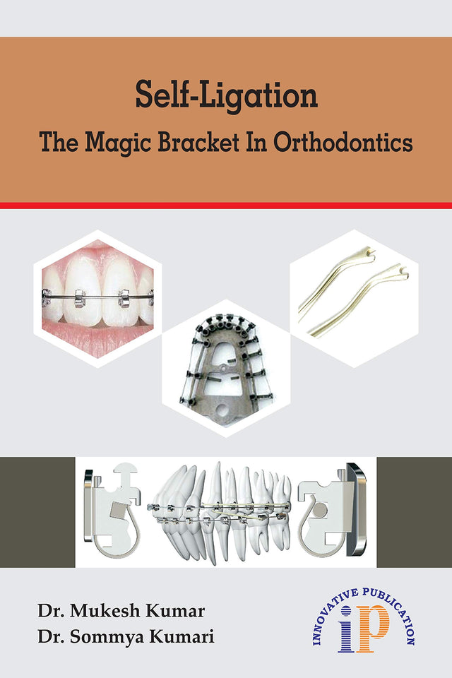 Self-Ligation - The Magic Bracket In Orthodontics - Retail Maharaj