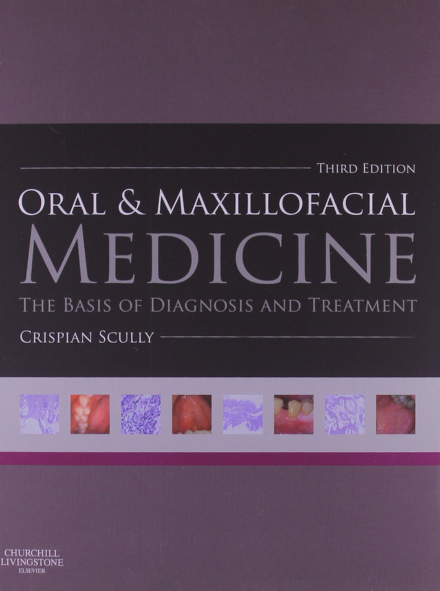 Oral and Maxillofacial Medicine: The Basis of Diagnosis and Treatment - Retail Maharaj