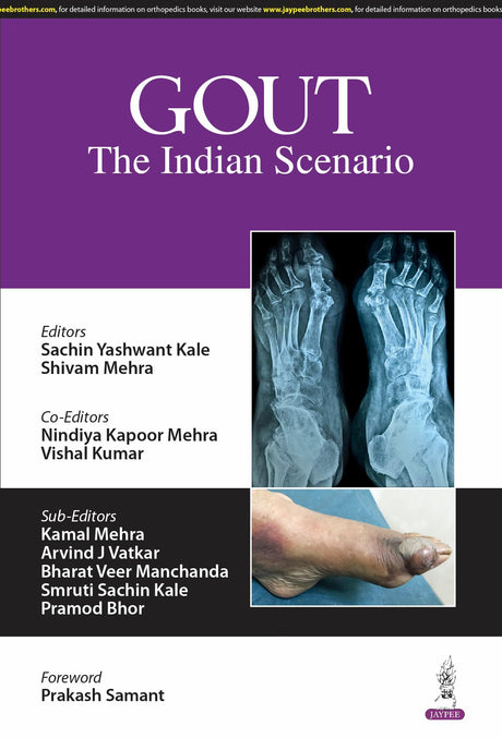 GOUT THE INDIAN SCENARIO - Retail Maharaj