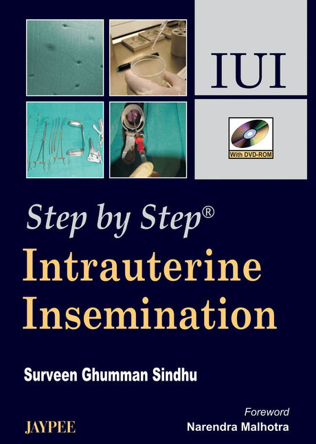 STEP BY STEP INTRAUTERINE INSEMINATION IUI WITH DVD-ROM - Retail Maharaj