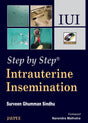 STEP BY STEP INTRAUTERINE INSEMINATION IUI WITH DVD-ROM - Retail Maharaj