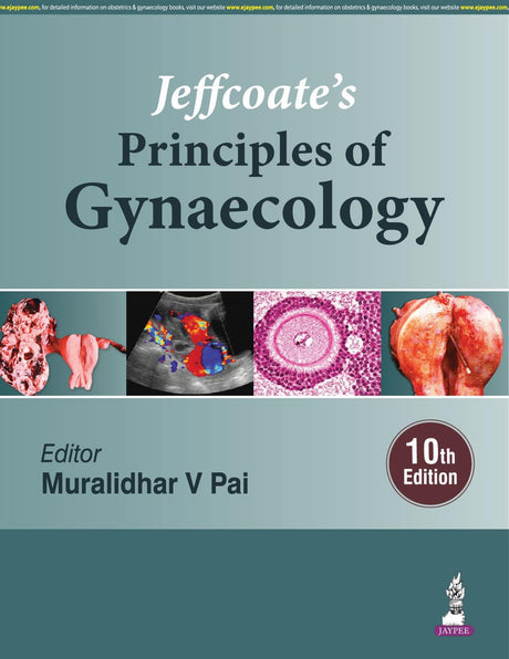 JEFFCOATE'S PRINCIPLES OF GYNAECOLOGY - Retail Maharaj