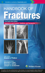 Handbook of fractures, 1st South Asian ed - Retail Maharaj