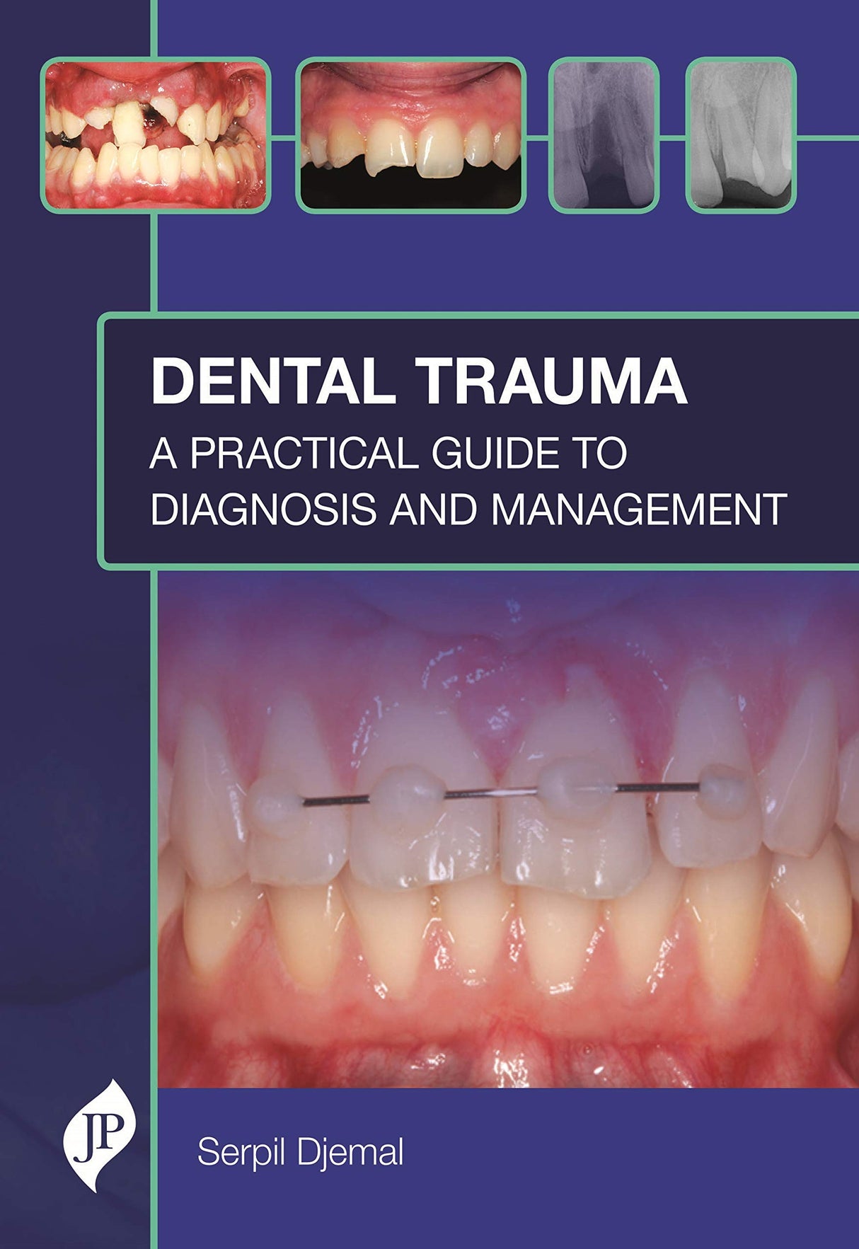 DENTAL TRAUMA: A PRACTICAL GUIDE TO DIAGNOSIS AND MANAGEMENT - Retail Maharaj