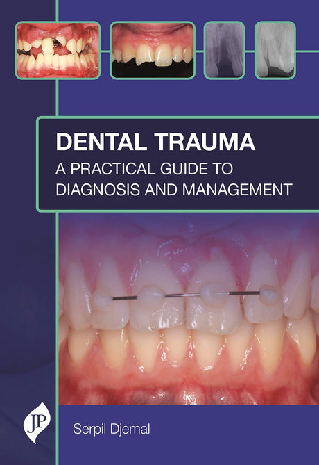 DENTAL TRAUMA: A PRACTICAL GUIDE TO DIAGNOSIS AND MANAGEMENT - Retail Maharaj