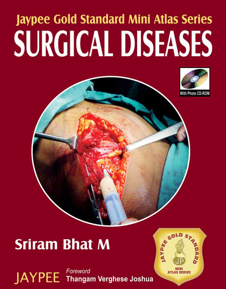 Jaypee Gold Standard Mini Atlas Series Surgical Diseases with Photo CD-ROM - Retail Maharaj