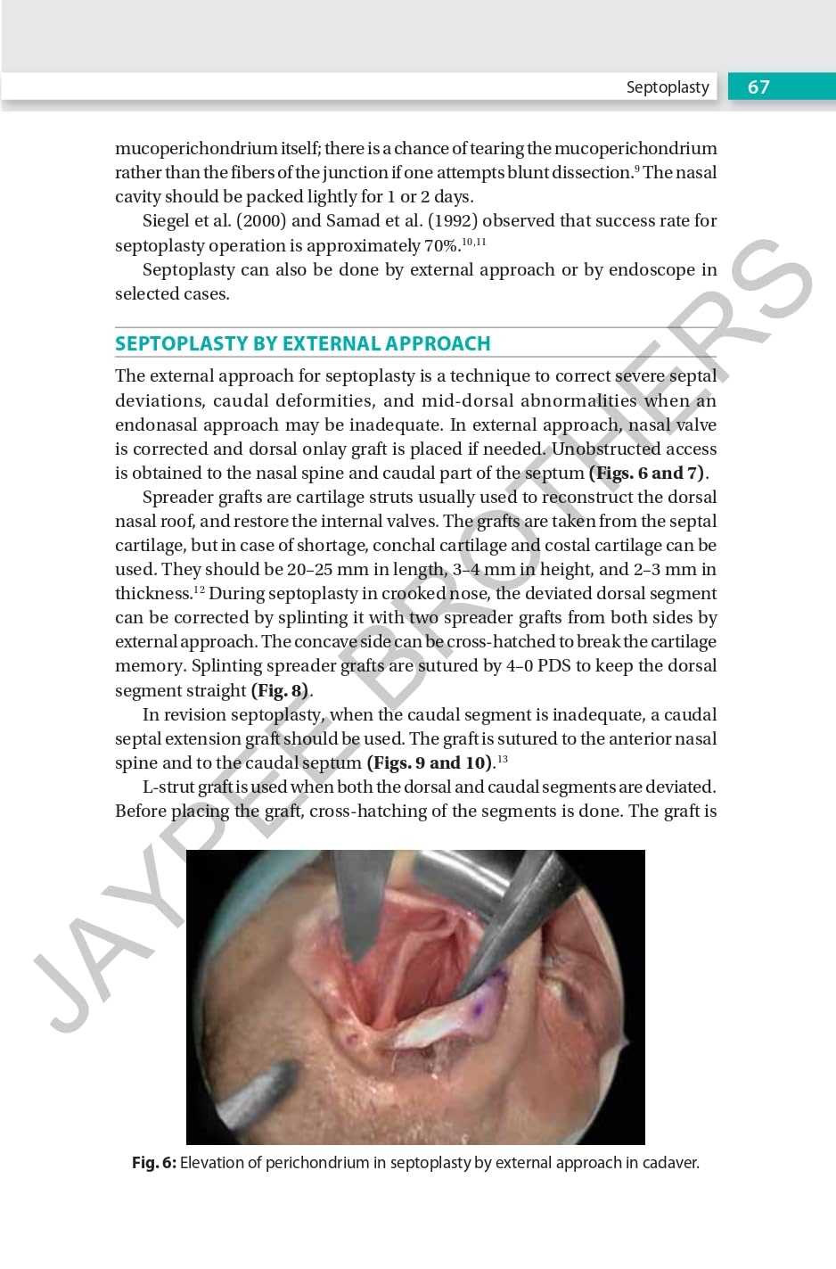 RHINOPLASTY AN EXPERT MANUAL - Retail Maharaj