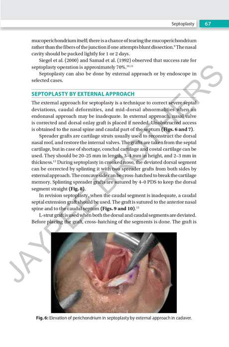 RHINOPLASTY AN EXPERT MANUAL - Retail Maharaj