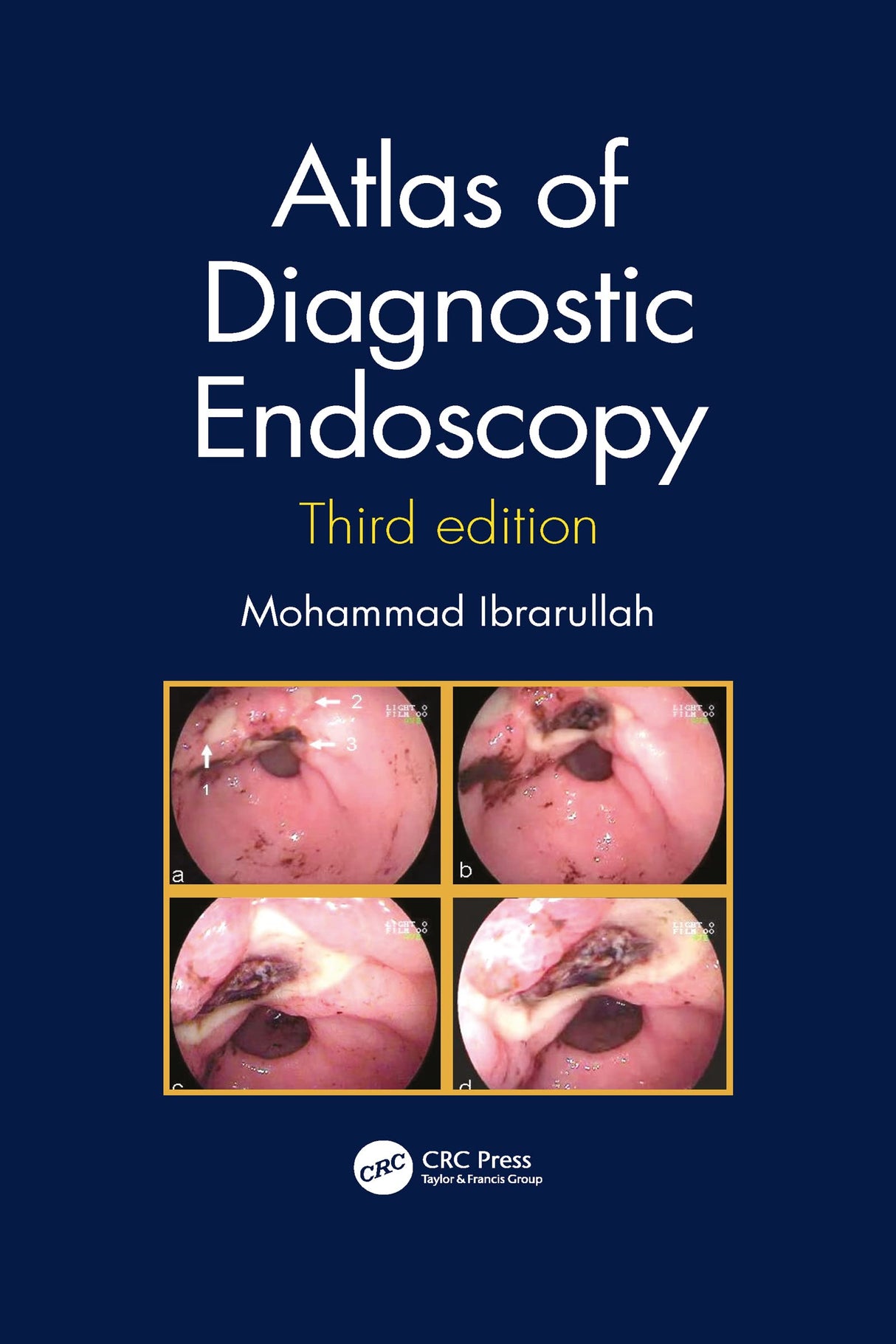 Atlas Of Diagnostic Endoscopy 3Ed (Pb 2021) - Retail Maharaj