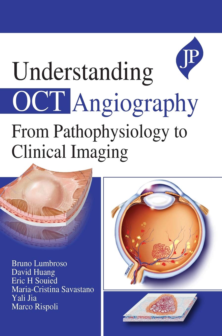 UNDERSTANDING OCT ANGIOGRAPHY FROM PATHOPHYSIOLOGY TO CLINICAL IMAGING - Retail Maharaj