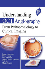 UNDERSTANDING OCT ANGIOGRAPHY FROM PATHOPHYSIOLOGY TO CLINICAL IMAGING - Retail Maharaj