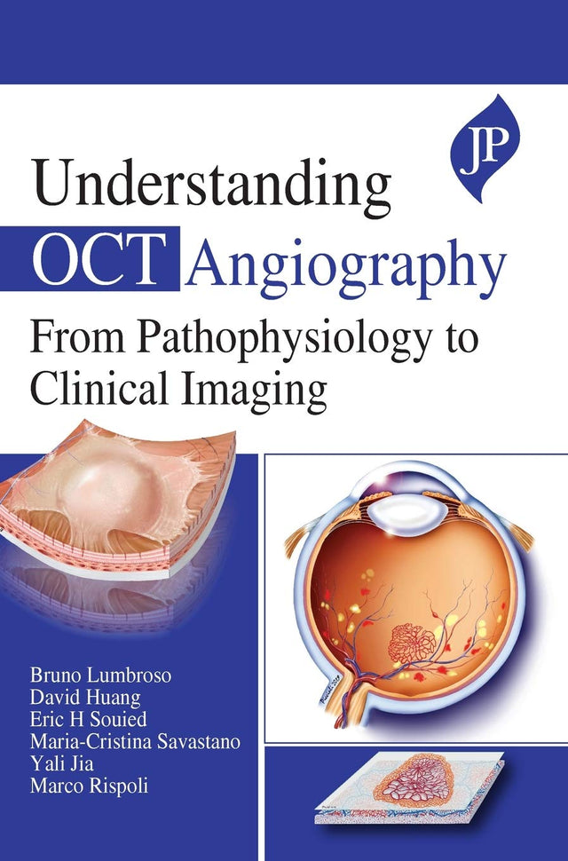 UNDERSTANDING OCT ANGIOGRAPHY FROM PATHOPHYSIOLOGY TO CLINICAL IMAGING - Retail Maharaj