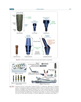 Textbook of Periodontology for Undergraduate Students - 2024 - Retail Maharaj