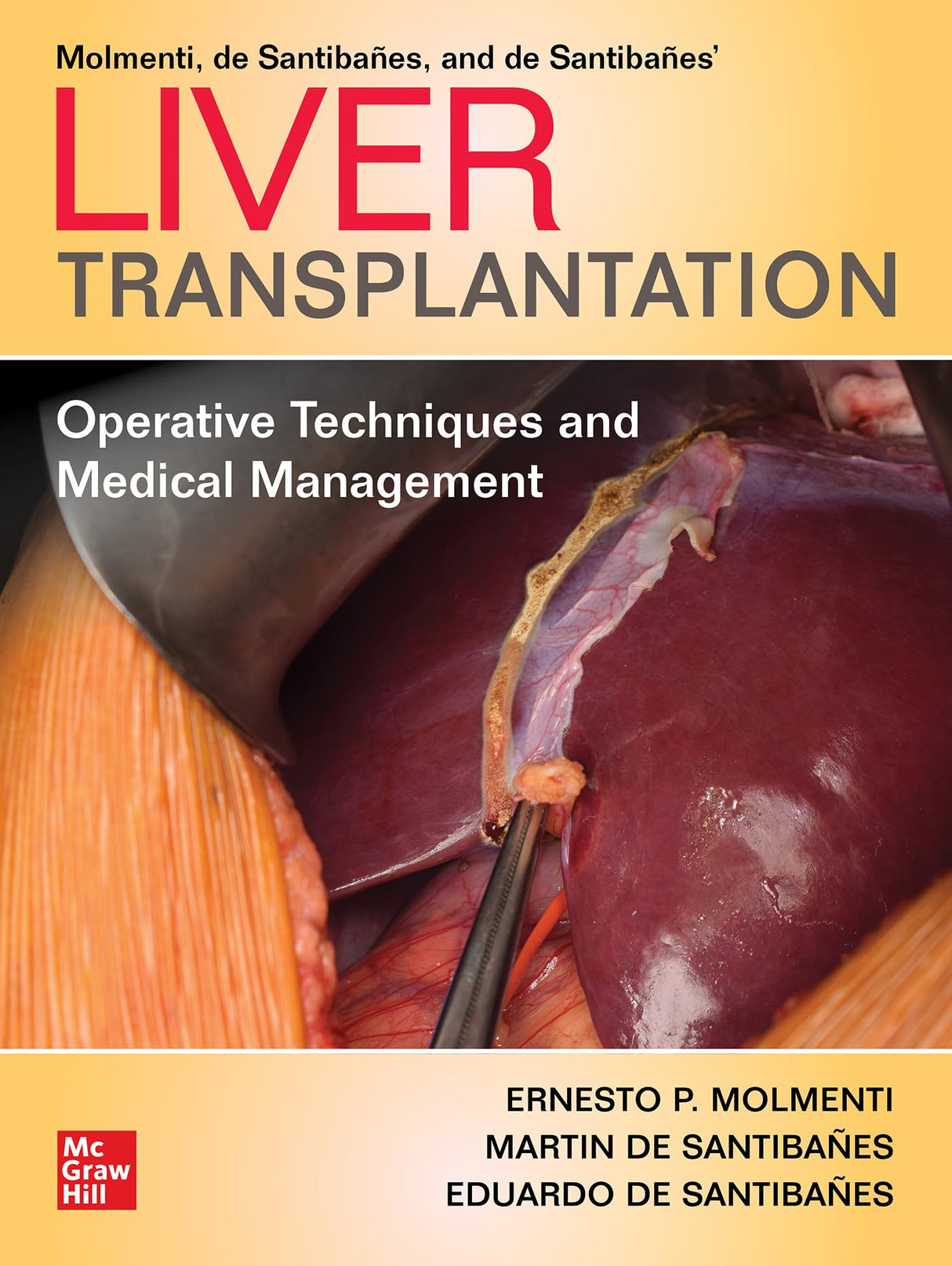 Liver Transplantation: Operative Techniques and Medical Management (SURGERY) - Retail Maharaj