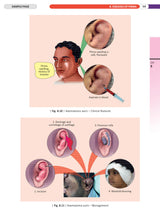 Illustrated Textbook of ENT and Head & Neck Surgery (1st Edition 2025) - Retail Maharaj