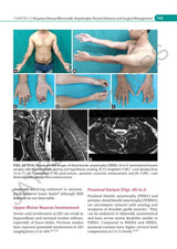 IAN ADVANCES IN NEUROMUSCULAR DISORDERS - Retail Maharaj