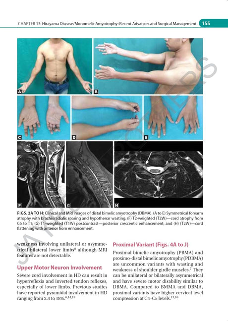 IAN ADVANCES IN NEUROMUSCULAR DISORDERS - Retail Maharaj