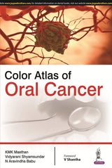 COLOR ATLAS OF ORAL CANCER - Retail Maharaj