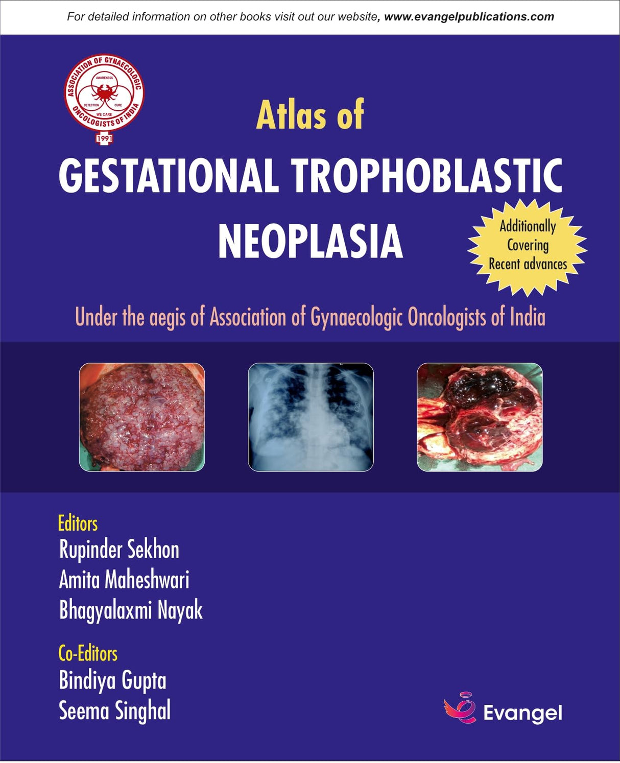 AGOI Atlas of GESTATIONAL TROPHOBLASTIC NEOPLASIA - Retail Maharaj