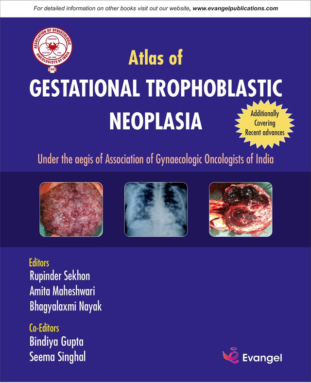 AGOI Atlas of GESTATIONAL TROPHOBLASTIC NEOPLASIA - Retail Maharaj
