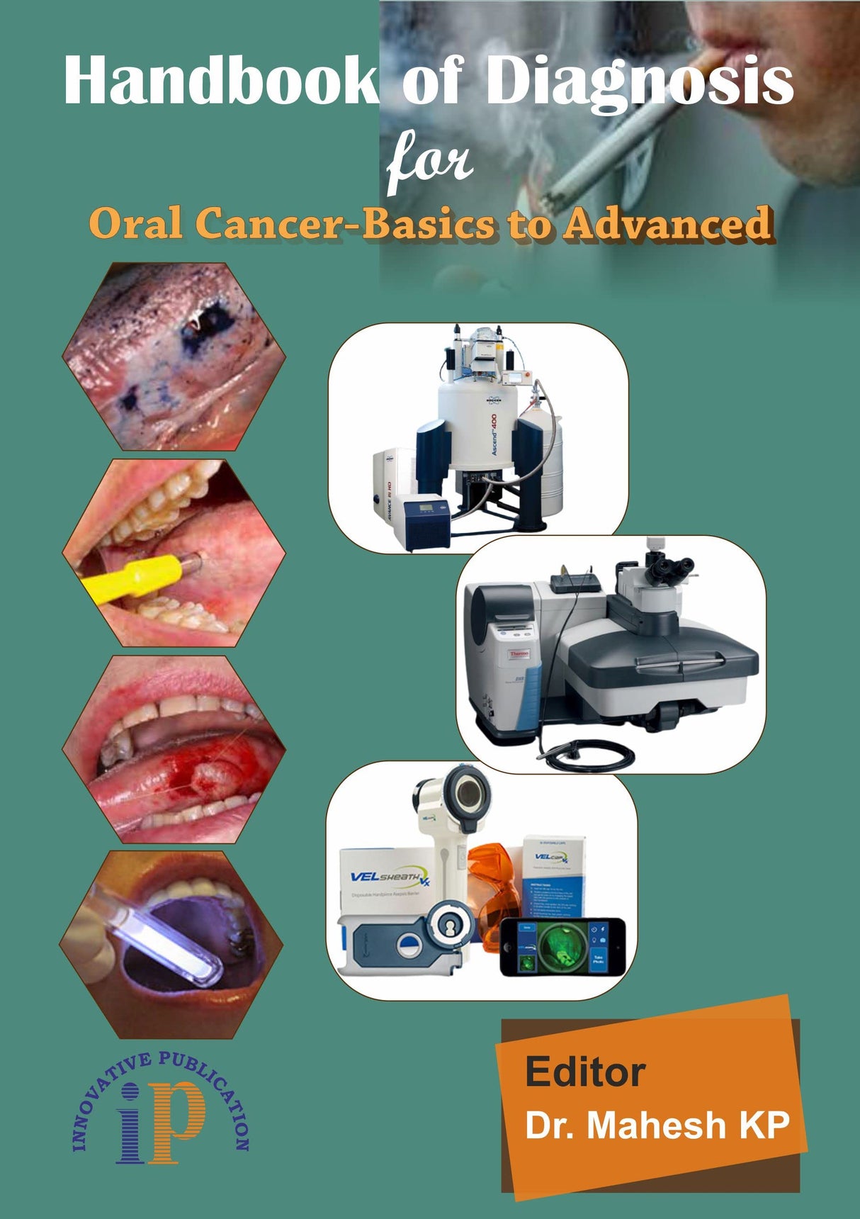 Handbook of Diagnosis for Oral Cancer-Basics to Advanced - Retail Maharaj