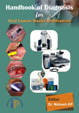 Handbook of Diagnosis for Oral Cancer-Basics to Advanced - Retail Maharaj