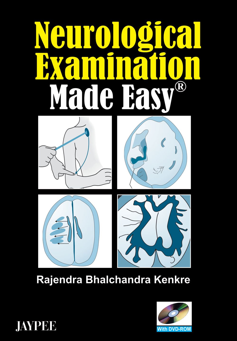 Neurological Examination Made Easy with DVD-ROM - Retail Maharaj
